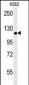POTEE Antibody (Center)